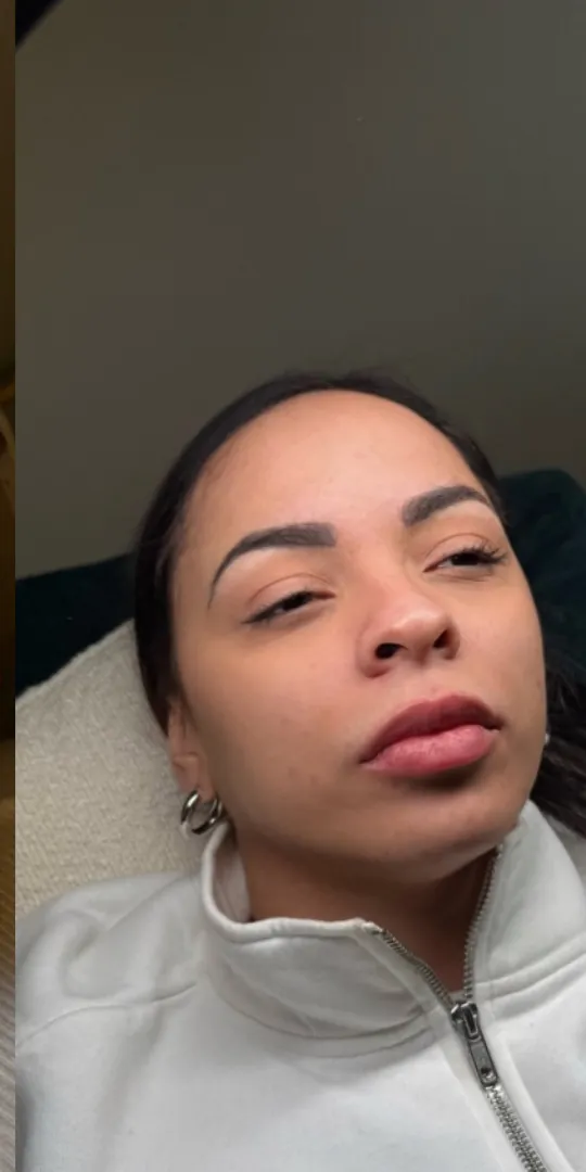 Brighter skin after treatment