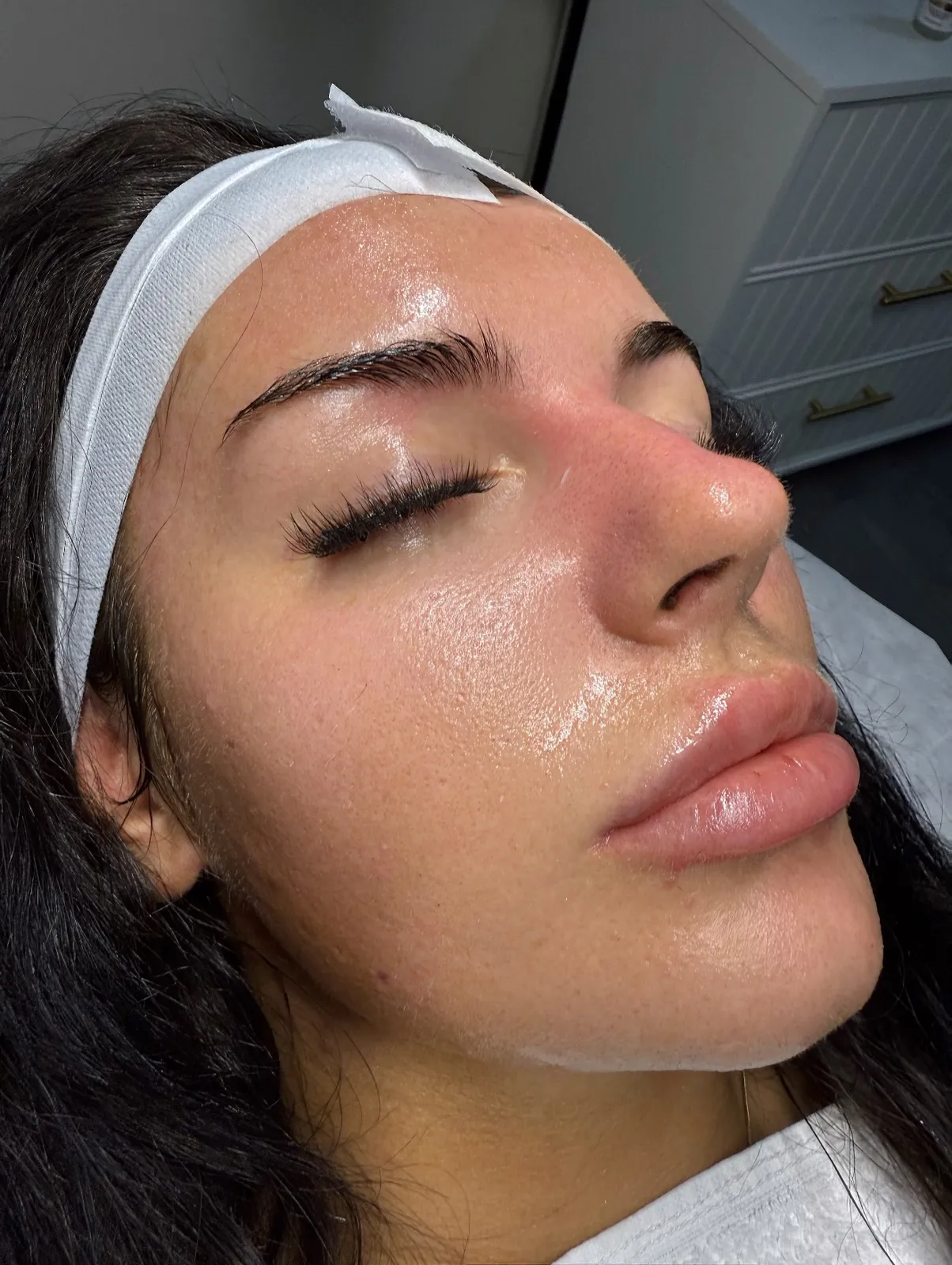 Hydrated, glowing skin after a facial treatment